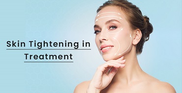 Skin Tightening in Ahmedabad